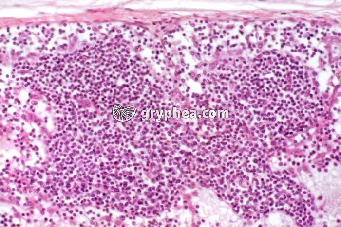 Ganglion lymphatique x100 - gryphea.org